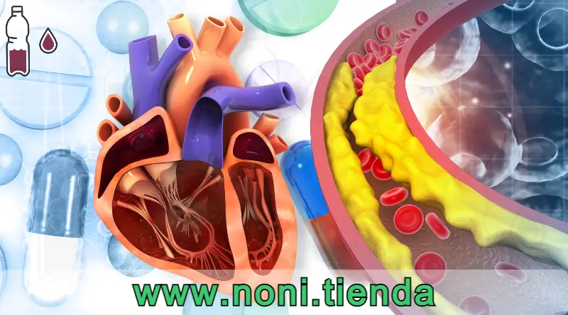 Explora las amplias posibilidades que te ofrece el mejor jugo de noni del mundo para aminorar los problemas cardiovasculares